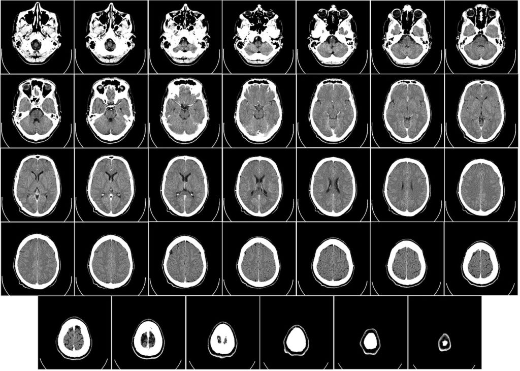 Le traitement d'image dans le domaine de la Biologie et du Médical